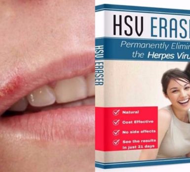 Herpes Erased Review