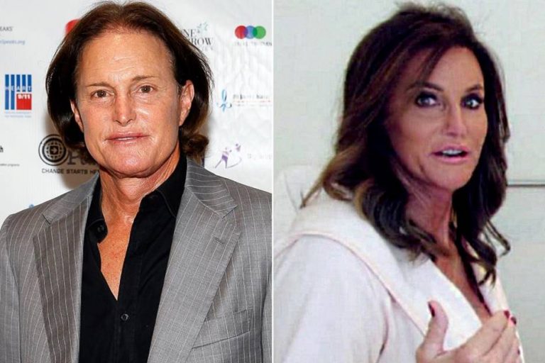 Bruce Jenner Before and After Plastic Surgery Photos Reveal More than